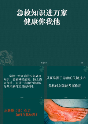 社区现场救护科普知识讲座课件