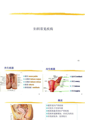 妇科疾病ppt课件