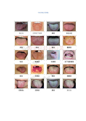 舌诊