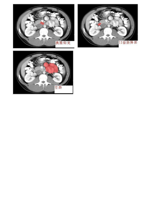 腹盆腔解剖图解CT