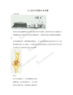 人工肘关节置换手术步骤