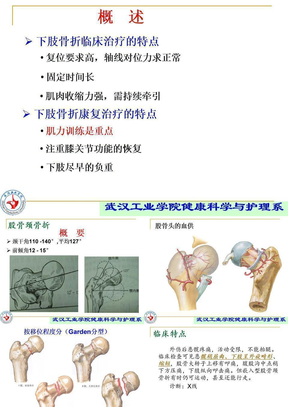 股骨颈骨折的康复