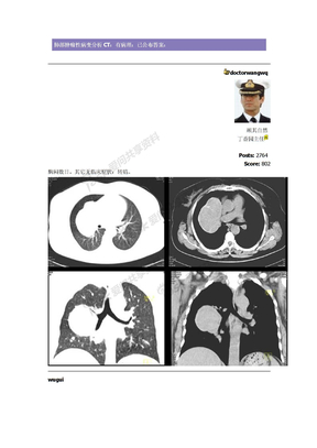 肺部肿瘤性病变分析CT　肝硬化性血管瘤