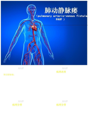 肺动静脉瘘ppt课件