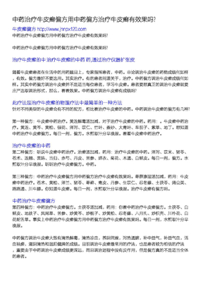 中药治疗牛皮癣 偏方 用中药 偏方 治疗牛皮癣有效果吗___1-120229134238