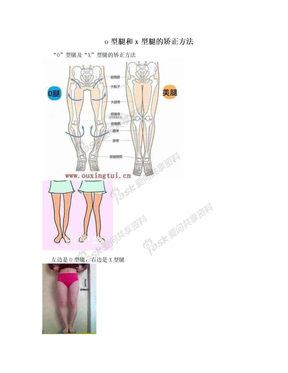 o型腿和x型腿的矫正方法