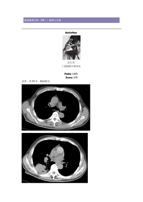 肺部病变分析　磷癌