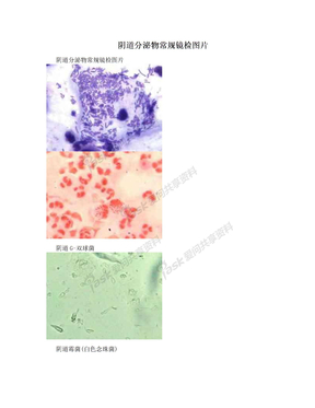 阴道分泌物常规镜检图片