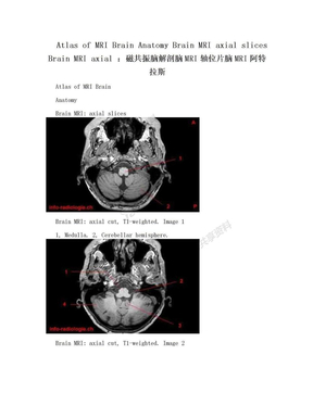 Atlas of MRI Brain Anatomy Brain MRI axial slices Brain MRI axial ：磁共振脑解剖脑MRI轴位片脑MRI阿特拉斯