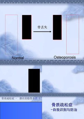 骨质疏松社区教育