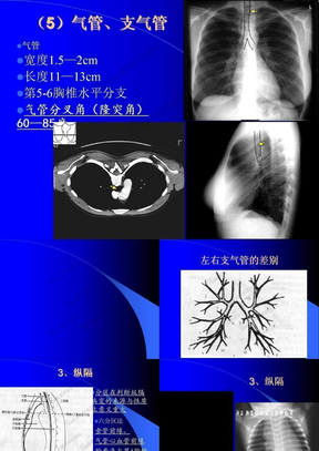 02-3肺与纵隔肺脓肿与原发性肺结核