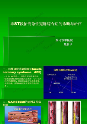 不稳定性心绞痛和非ST段抬高心肌梗死