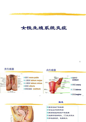 妇科疾病ppt课件