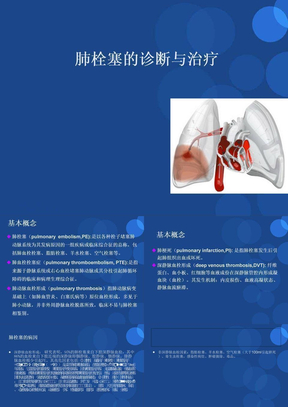 肺栓塞ppt课件