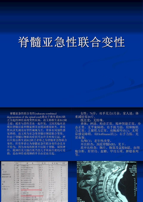 小儿急性胰腺炎第4单元 急性脊髓炎脊髓灰质炎重症急性胰腺炎临床