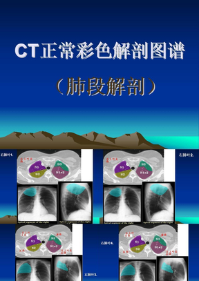 肺部CT解剖图谱