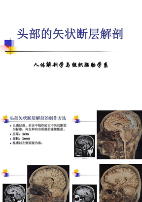 頭部解剖