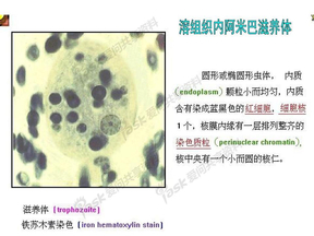 医学寄生虫实验考试图片整理