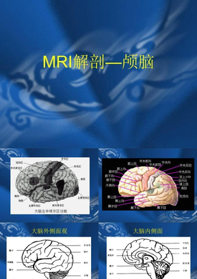 MRI解剖—颅脑