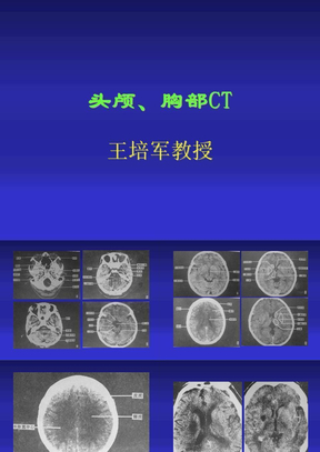 头颅、胸部CT-CT学习资料