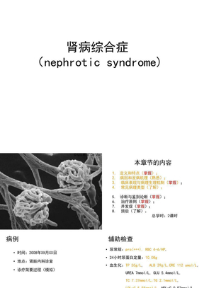 肾病综合症1