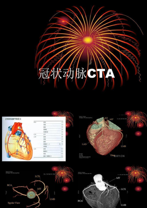 冠状动脉CTA