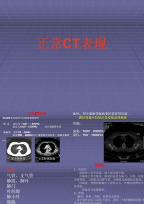 正常胸肺部CT影像学