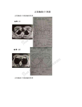 正常胸部CT图谱