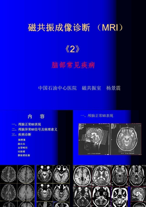 2-磁共振成像诊断 （MRI）脑部疾病