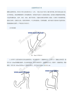 胃、十二指肠手术