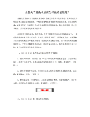 全髋关节置换术后功能锻炼