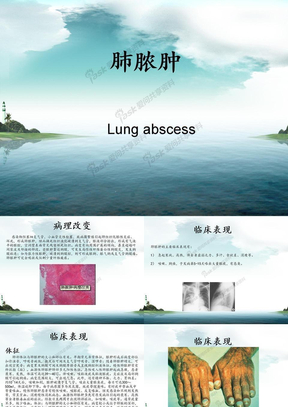 治疗肺脓肿