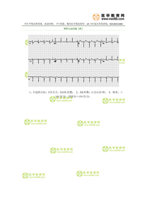 临床医师实践技能窦性心动过速（图）