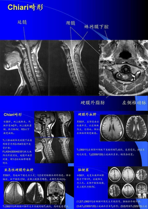 MRI图像-脑-01