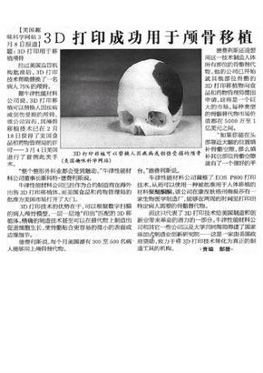 3D打印成功用于颅骨移植