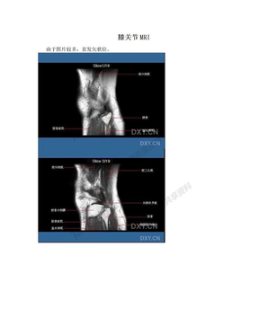 膝关节MRI