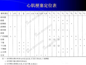 心肌梗塞定位表