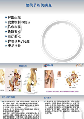 髋关节置换术后功能锻炼演示